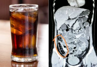 uses-of-coke