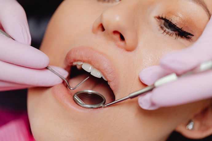 8-wisdon-teeth-removal-recovery-tips-dental