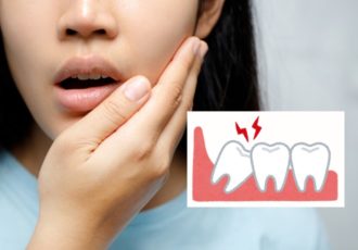 8 Wisdon Teeth Removal Recovery Tips Feature