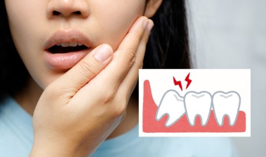 8 Wisdon Teeth Removal Recovery Tips Feature