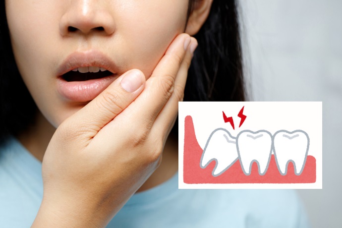 8 Wisdon Teeth Removal Recovery Tips Feature