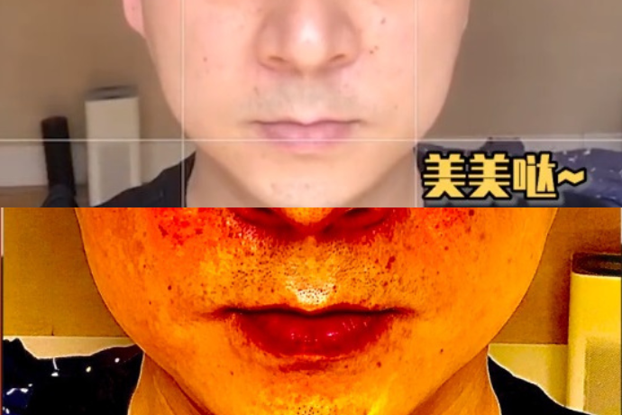 Camera Test Skin Type Before After