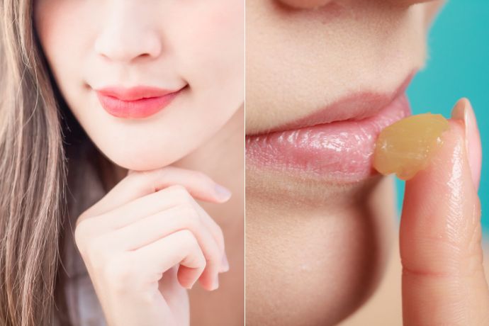 Causes And Treatment Of Chapped Lips Feature
