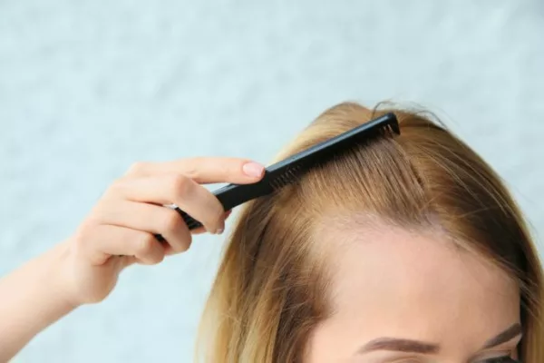 Self Assessment For Excessive Hair Loss 2