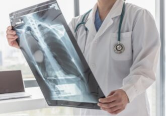 6-type-people-at-high-risk-of-lung-cancer