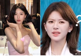 Zhao Lu Si Suspected Plastic Surgery 13