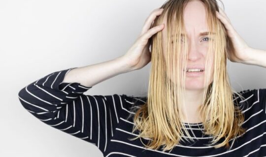 What To Do When Your Hairline Keeps Receding Woman