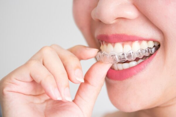 Why Need To Wear Retainer After Orthodontics2