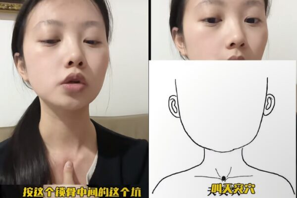 3 Methods To Cough Up Phlegm From Your Throat