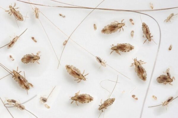 Head Louse