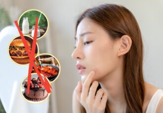 3 Foods To Avoid For Better Skin (4)